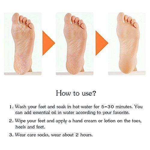 Anti Crack silicone Gel Foot Protector Moisturizing Socks